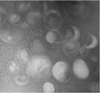 Nano-Liposomes Formulation Production