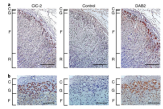 expression-of-clc-2-in-human-adrenal-gland