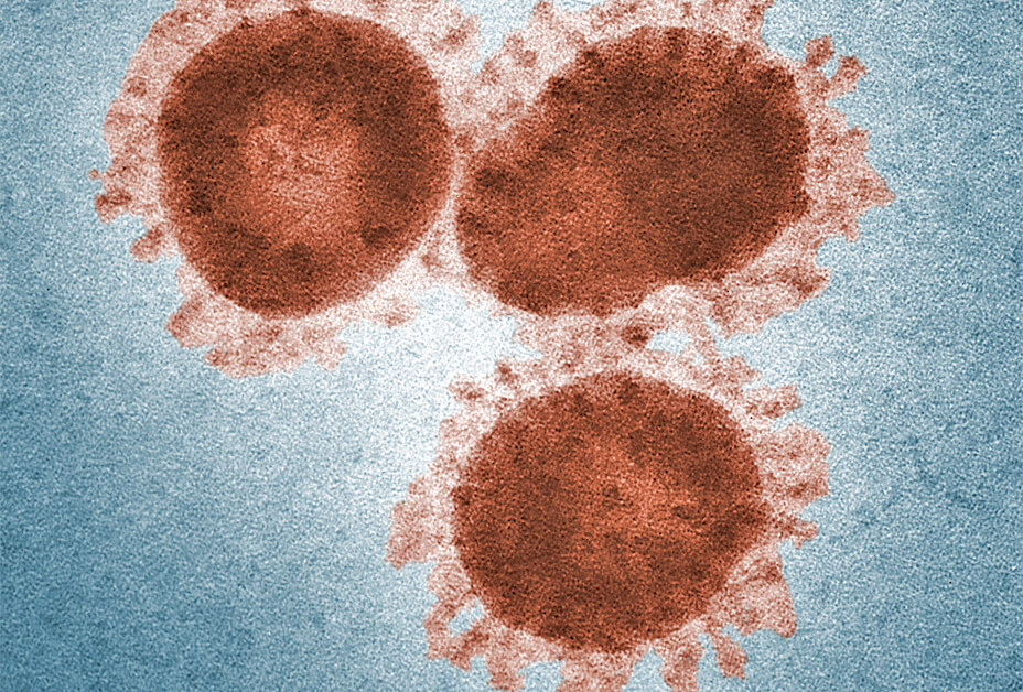 Electron microscope image of SARS-CoV.