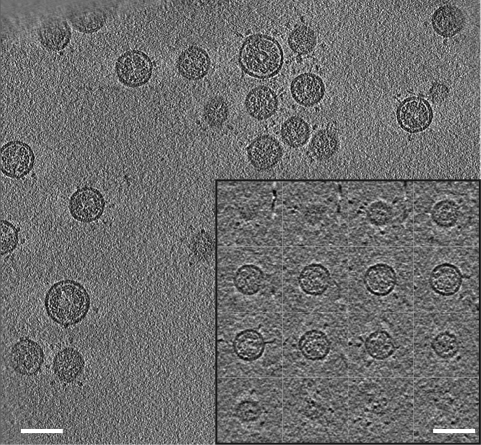 Cryo-electron tomography of MHV.