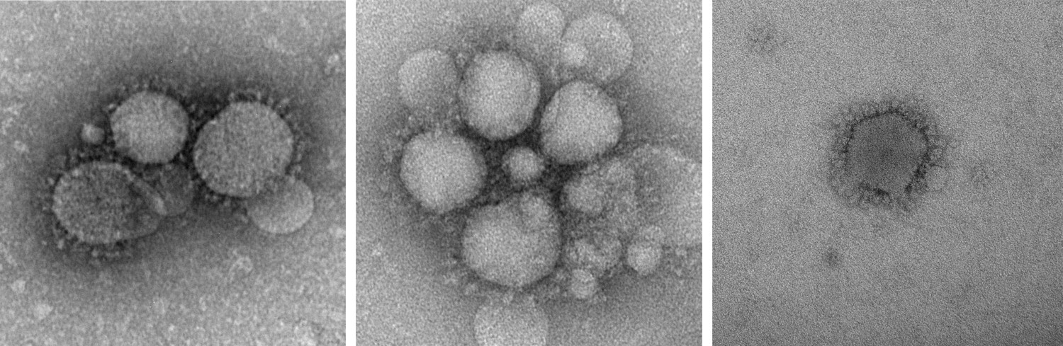 MERS-CoV particles as observed by negative staining EM.
