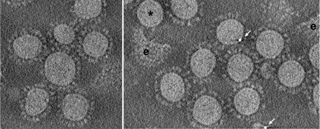 Protein Structure Analysis Using Cryo-ET for Coronavirus Research