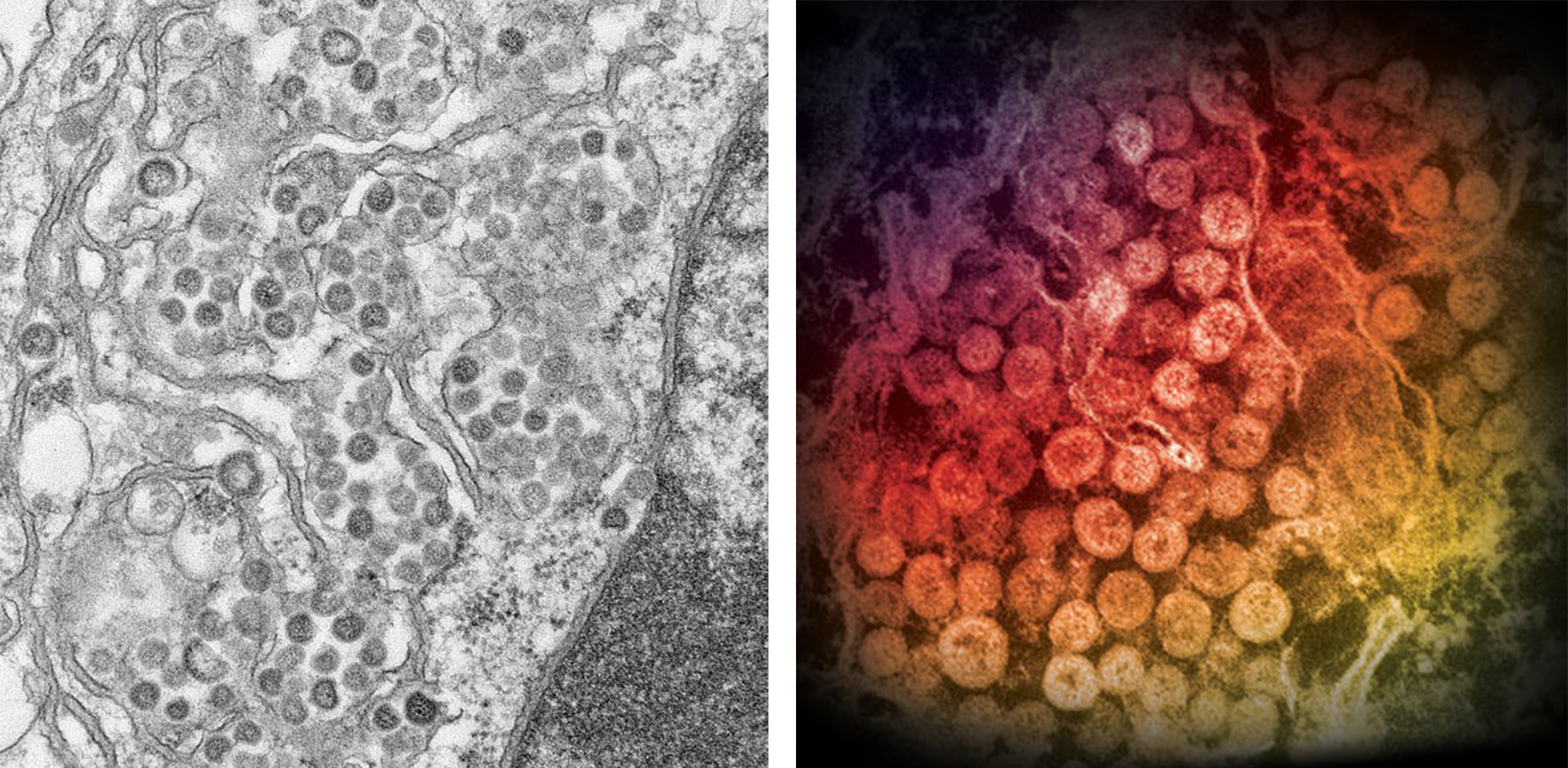  Electron micrographs of ultra-thin sections of MERS-CoV. 