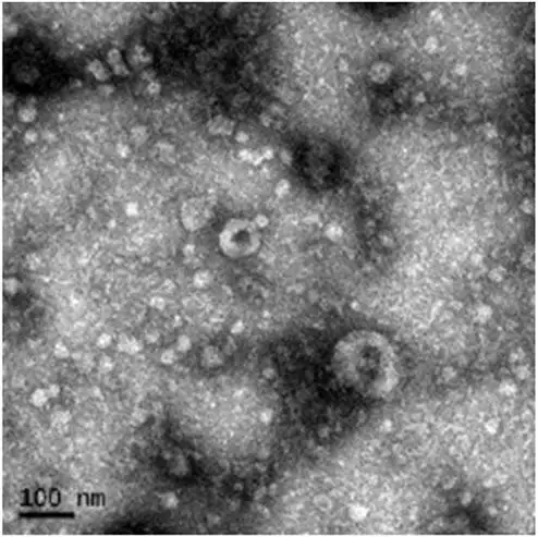 TEM image of hucMSC-exosomes showing round, membrane-bound vesicles.