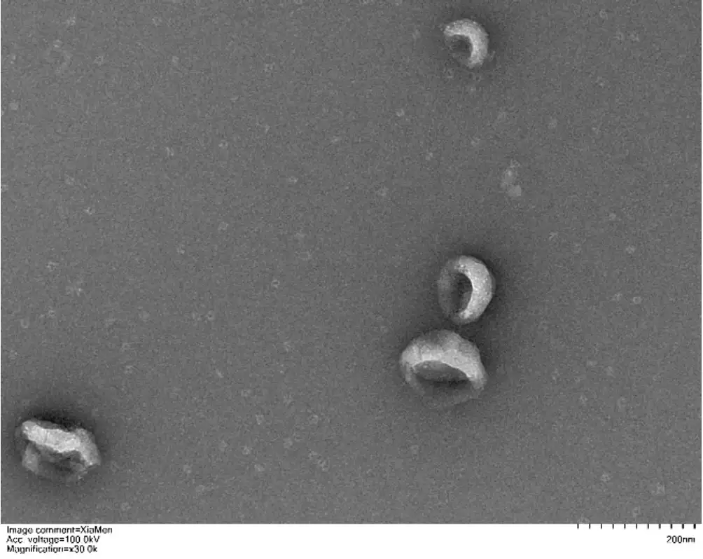 Transmission electron microscopy image showing the characteristic round shape and size of isolated exosomes.