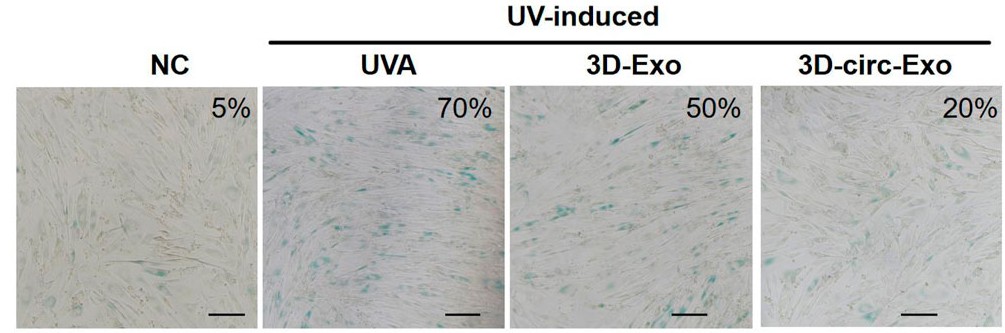 Establishment and validation of chronic photoaging HDFs model with SA-β-gal staining.