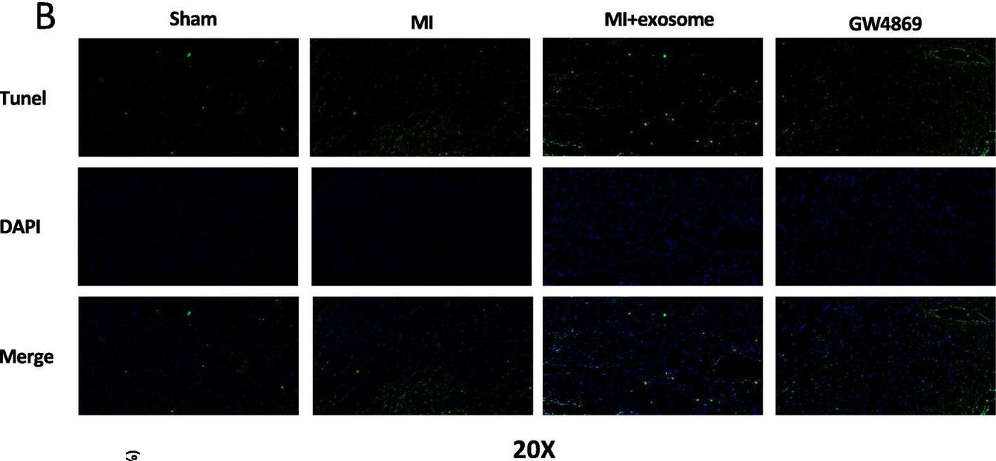Immunohistochemistry image showing reduced apoptosis in cardiomyocytes treated with exosomes.