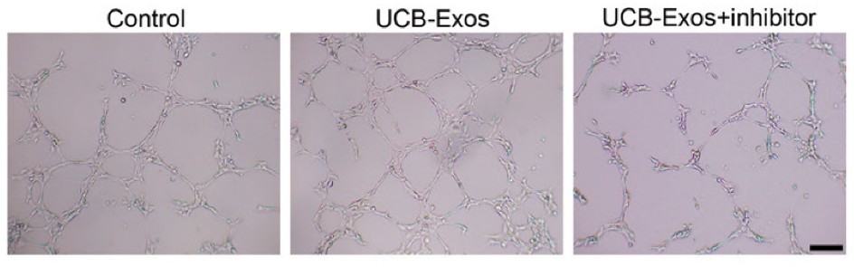 Micrographs of enhanced tube formation after UCB-Exos treatment.