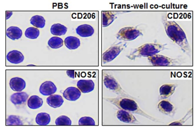 CD206 and NOS2 staining in RAW264.7 cells treated with MDA-MB-231 exosomes.