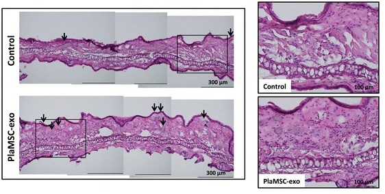 Murine auricle sections after PlaMSC-exo infusion, highlighting increased small blood vessels.