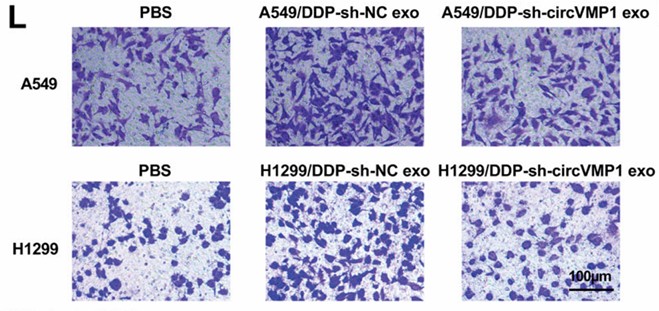 Workflow of exosome functional assays from consultation to delivery of comprehensive analysis report.