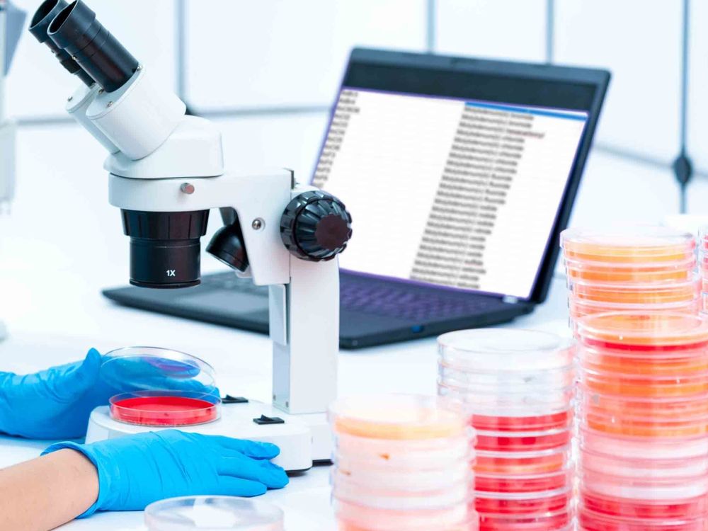Microscope image of a transwell functional assay, visualizing how exosomes enhance the migration and invasion of lung cancer cells.