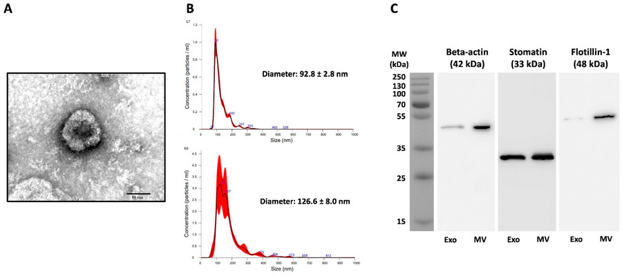 TEM, NTA, and Western blot analyses of exosomes and microvesicles derived from P. falciparum 3D7 culture supernatants.