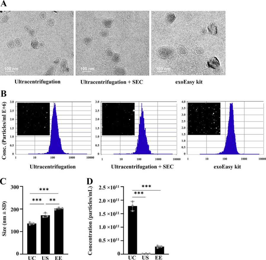 TEM and NTA analysis of bovine serum exosomes isolated by ultracentrifugation, SEC, and exoEasy kit.