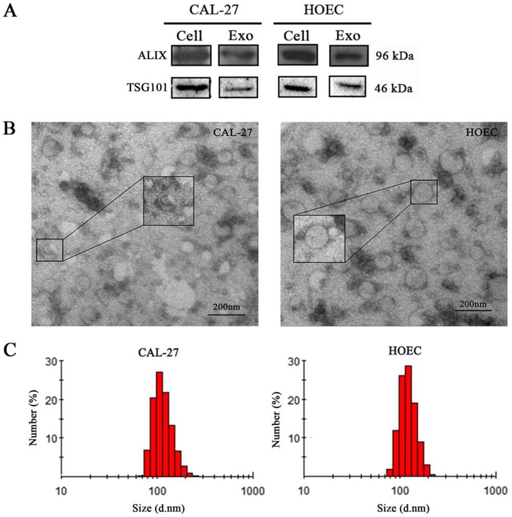 Exosome identification by Western blot, TEM, and Zetasizer Nano ZS showing ~100 nm mean size.
