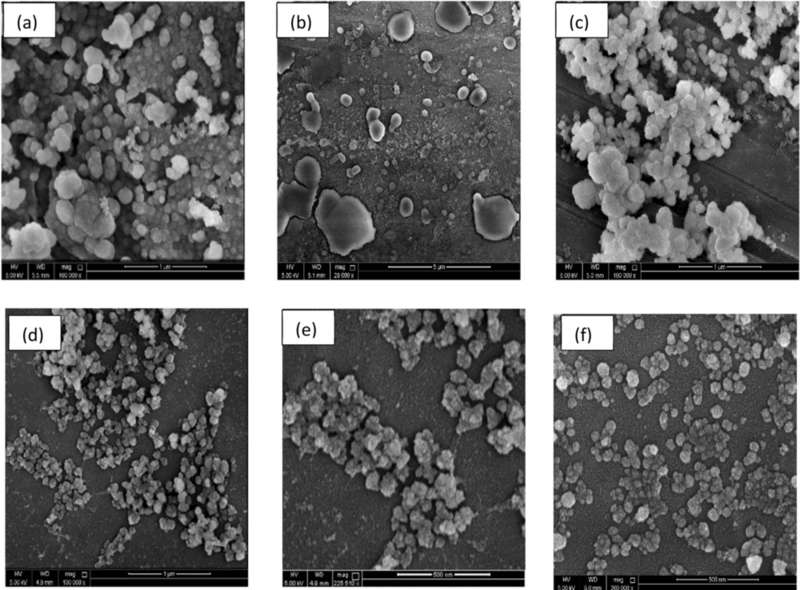 SEM images of NSCLC-derived EVs showing exosomes (30-100 nm) distinct from apoptotic vesicles and necrotic bodies (300-500 nm).