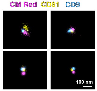 dSTORM three-color imaging of EVs showing CD81, CD9, and membrane markers with 100 nm scale.