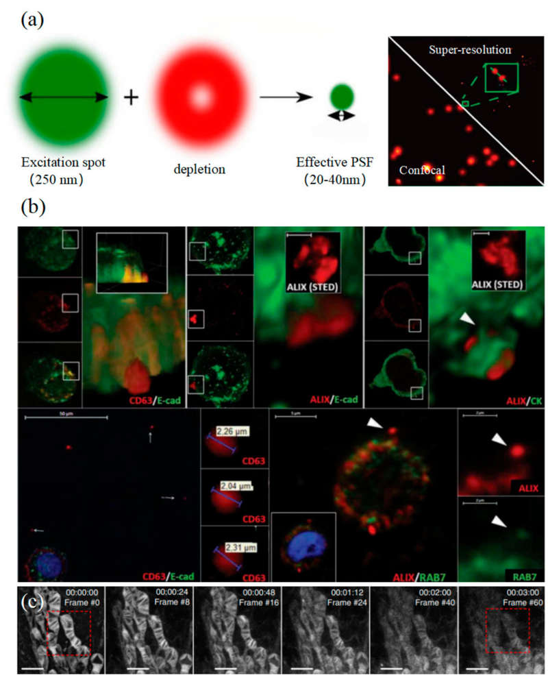 STED Microscopy Exosome Imaging Service