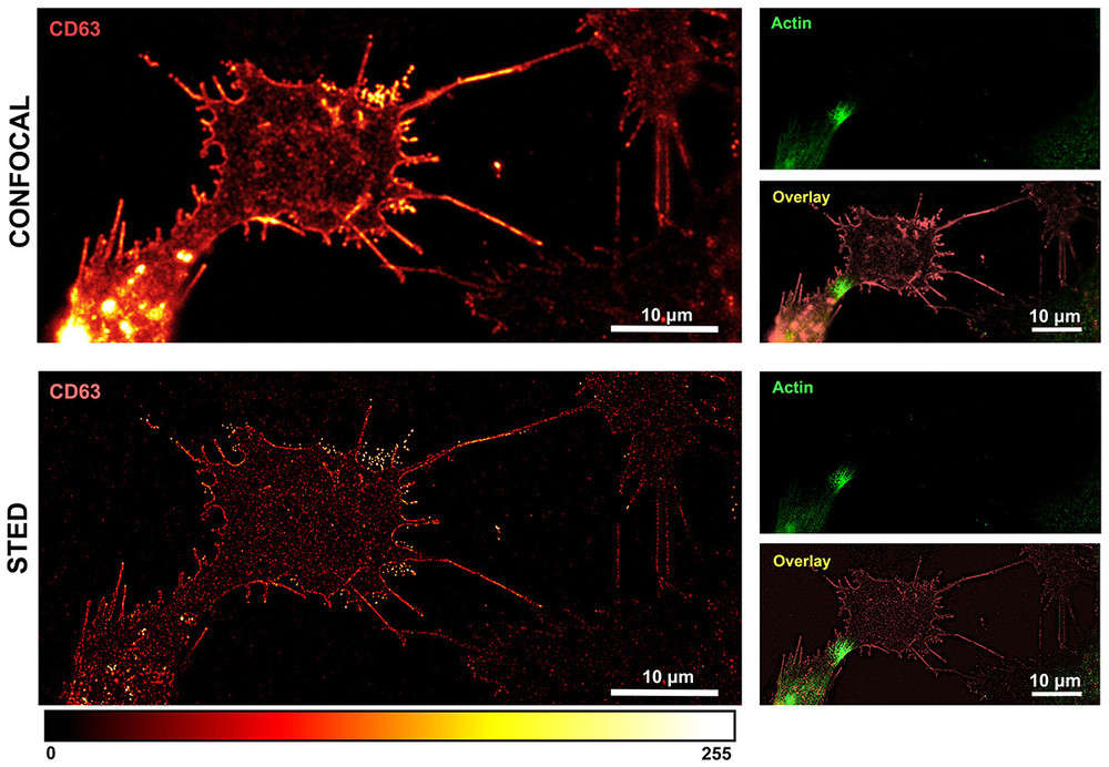 Confocal vs STED microscopy showing nanoscale resolution of CD63-positive exosome clusters in glioma cells.