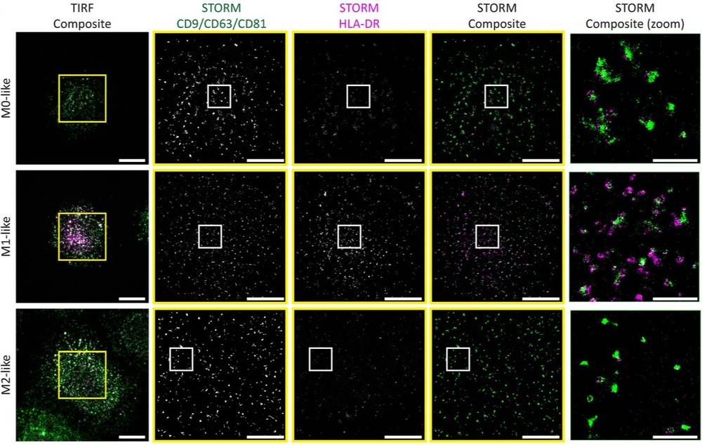 STORM images of M1-like macrophage EVs showing elevated MHC class II.