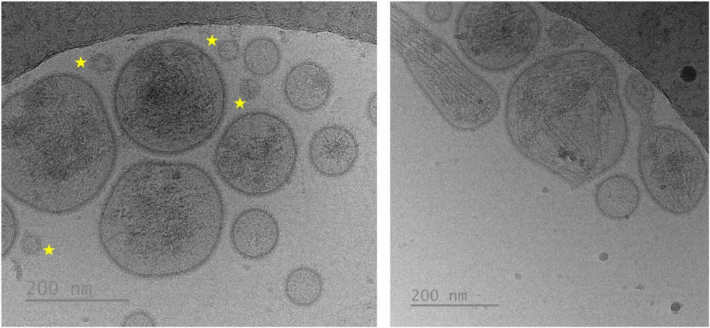 Cryo-EM images showing structural diversity of porcine seminal sEVs and non-vesicular particles lacking membranes.