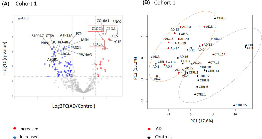 Volcano plot shows elevated C1q in AD; PCA separates AD and controls, indicating distinct proteomic profiles.