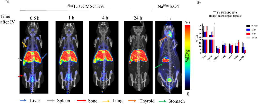 SPECT/CT shows Tc-99m exosomes accumulate in liver and spleen with urinary clearance and low thyroid uptake.
