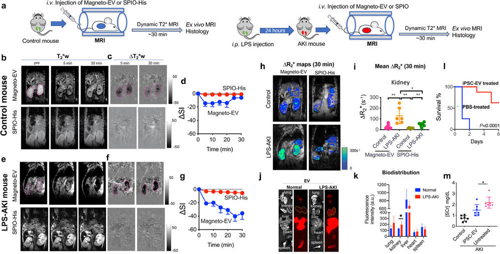 MRI tracking of SPION exosomes showing kidney uptake differences in control and injury models over time.