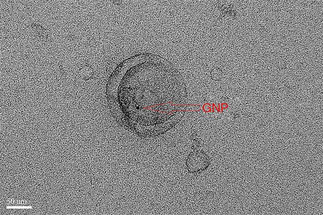 TEM image showing GNPs associated with exosomes after 10 h incubation at 37&deg;C, confirming successful labeling.