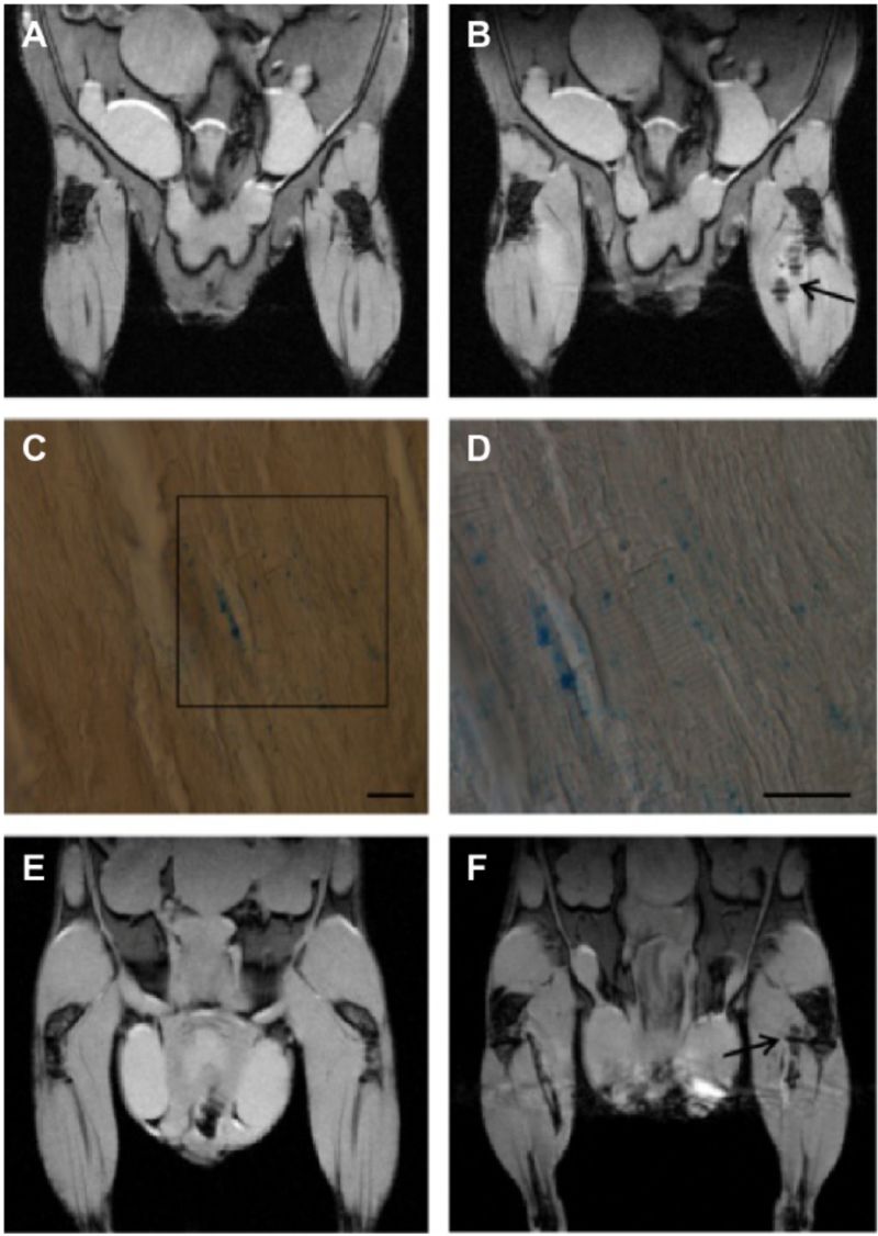 MRI and histology of USPIO-labeled exosomes showing in vivo muscle accumulation and iron signal validation.