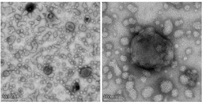 TEM images show 4T1-derived ELNs with spherical, nonaggregated nanostructures at different magnifications.