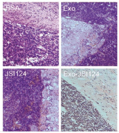 HE staining of brain tumor sections.