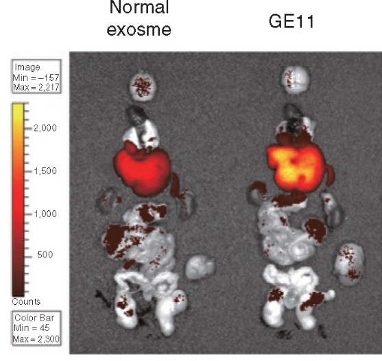 Exosome migration to tumor tissues in vivo.