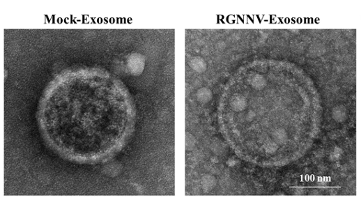 TEM analysis of exosomes from RGNNV-infected GK cells.
