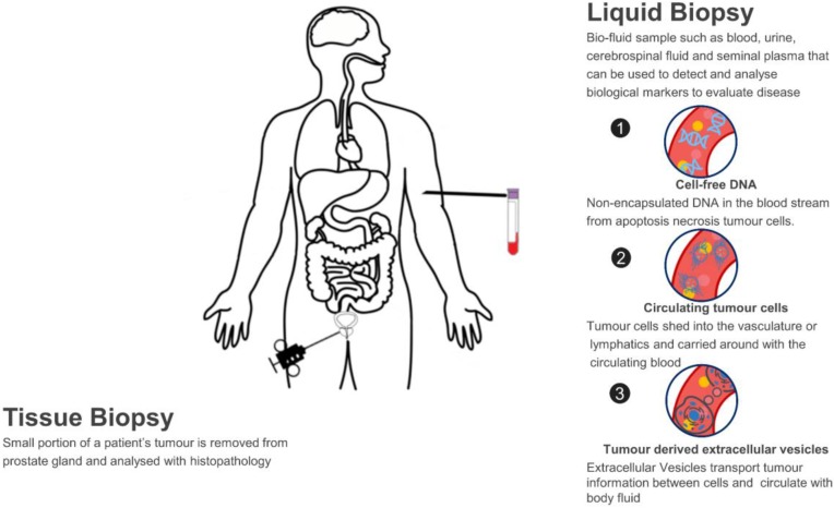 Extracellular Vesicle Biomarker Discovery