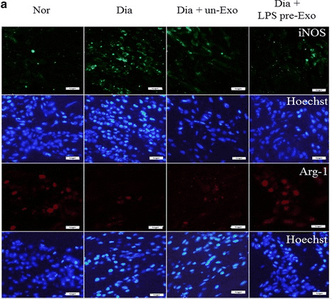 Immunofluorescence of macrophage phenotypes in wound.