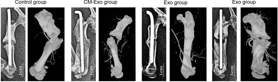 Increased vascularization in fracture site with Exo treatment.