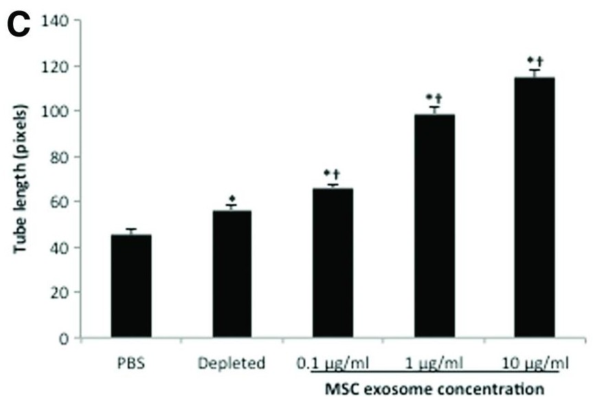 Bar graph of MSC exosomes enhancing angiogenesis.