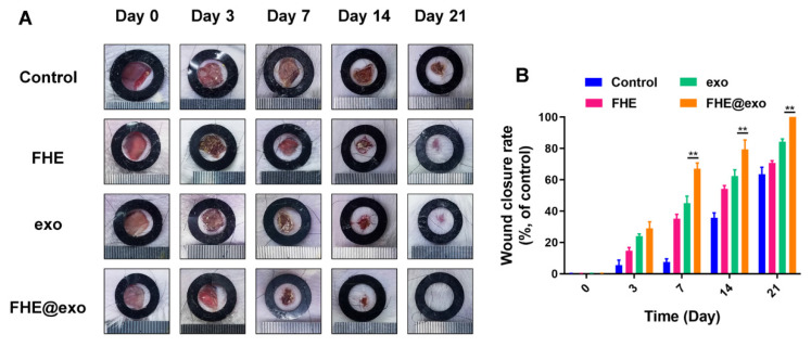 Wound closure with FHE-Exo hydrogel treatment.