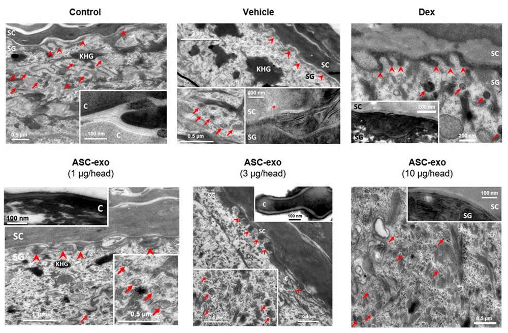 Impact of ASC-exosomes on epidermal lamellar bodies.