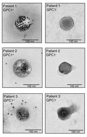 TEM images of GPC1+ and GPC1− crExos.