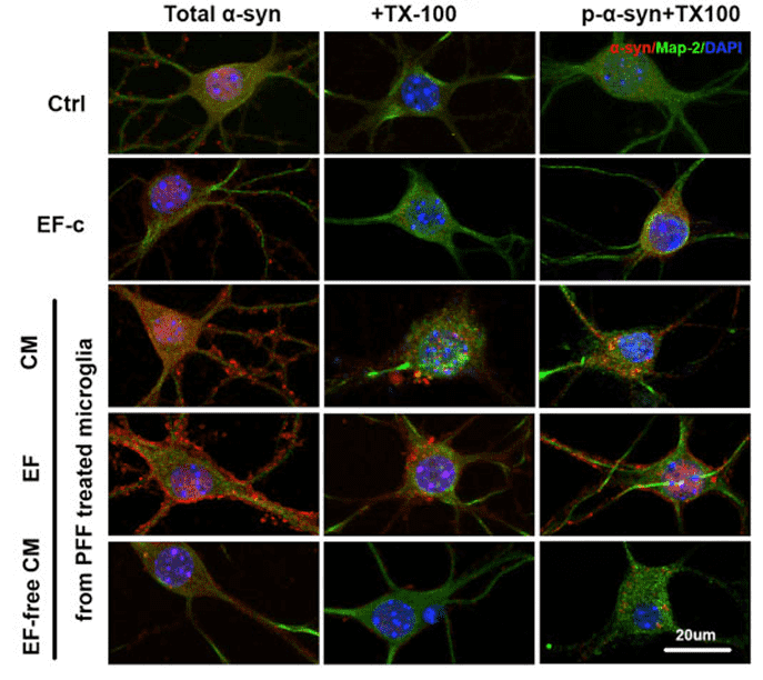&alpha;-Synuclein aggregation induced by microglia-derived exosomes.
