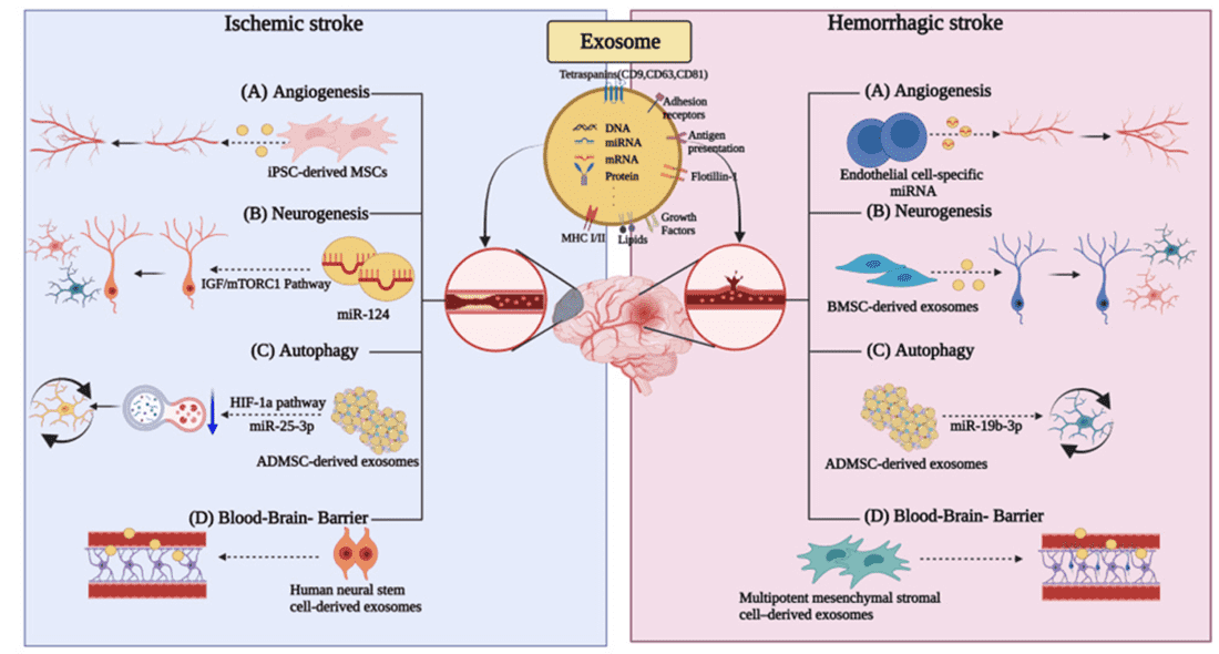 Exosome roles in stroke types and related processes.