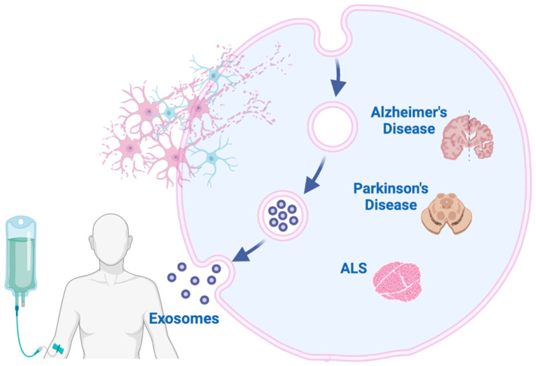 Neurological Disease Exosome Solutions