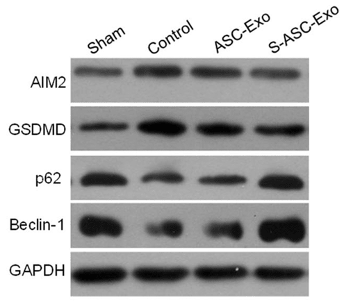 Western blot results for proteins involved in pyroptosis and mitophagy.