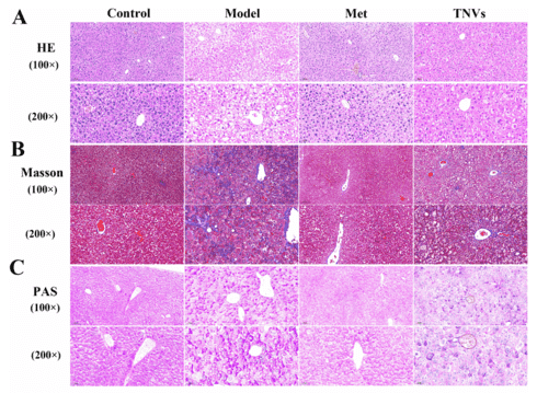 Histological analysis of liver in db/db mice with TNV treatment effects.