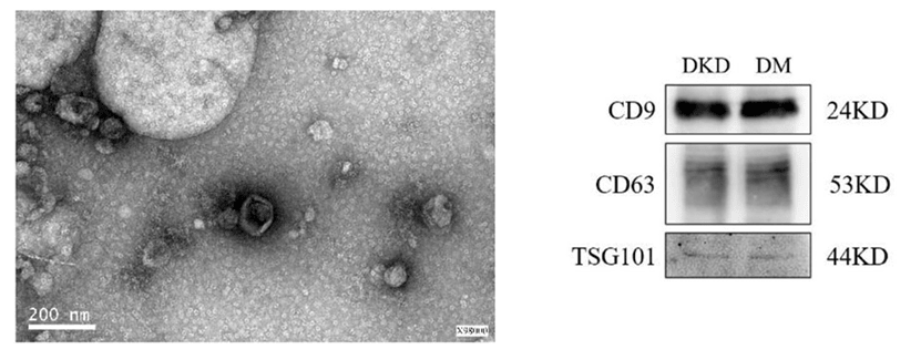 Exosome morphology and marker characterization.