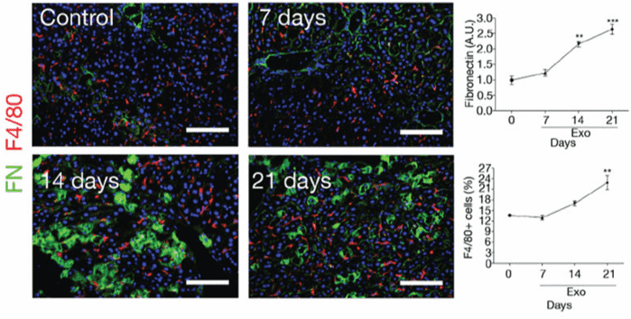 Exosomes from pancreatic cancer induce liver fibronectin and cell migration.