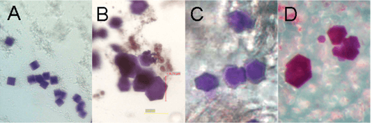 CIMP crystallization of  bacteriorhodopsin. 