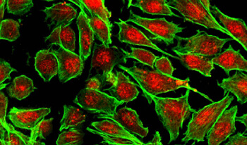 Mammalian Cell Systems